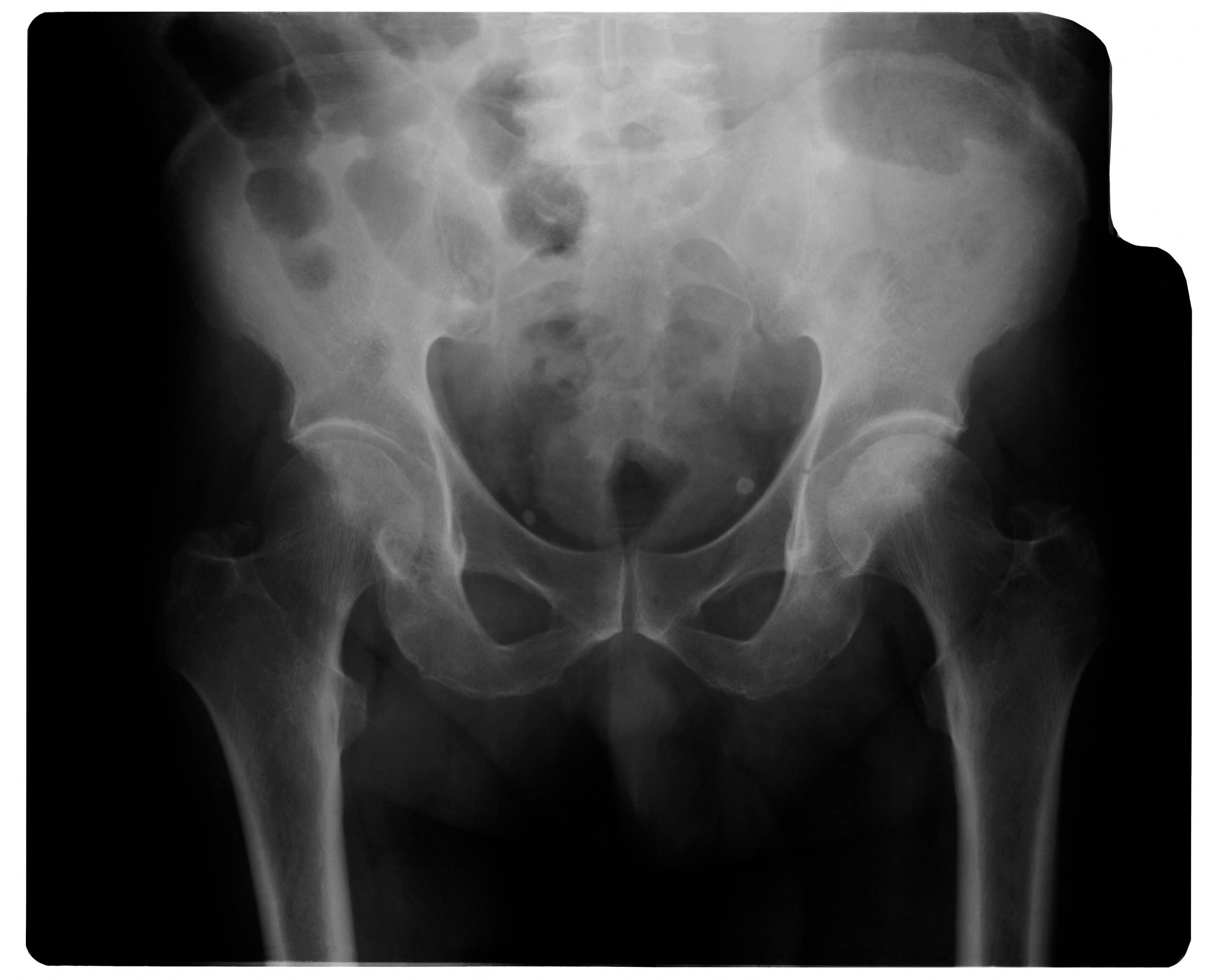 orgasm X ray